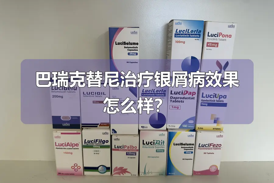 巴瑞克替尼治疗银屑病效果怎么样？